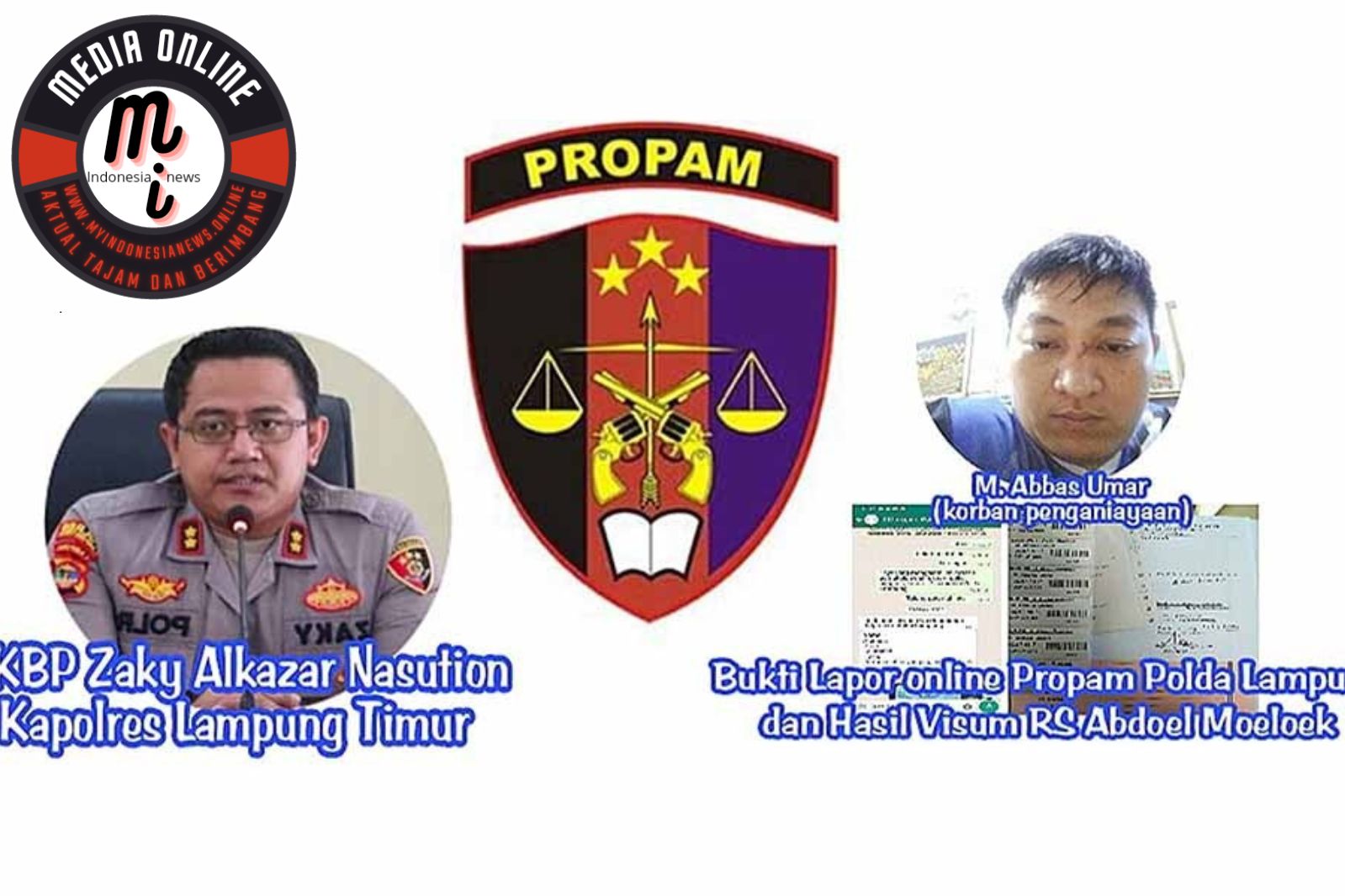 Menuntut Keadilan: Kasus Penganiayaan Oknum Polisi di Lampung Timur